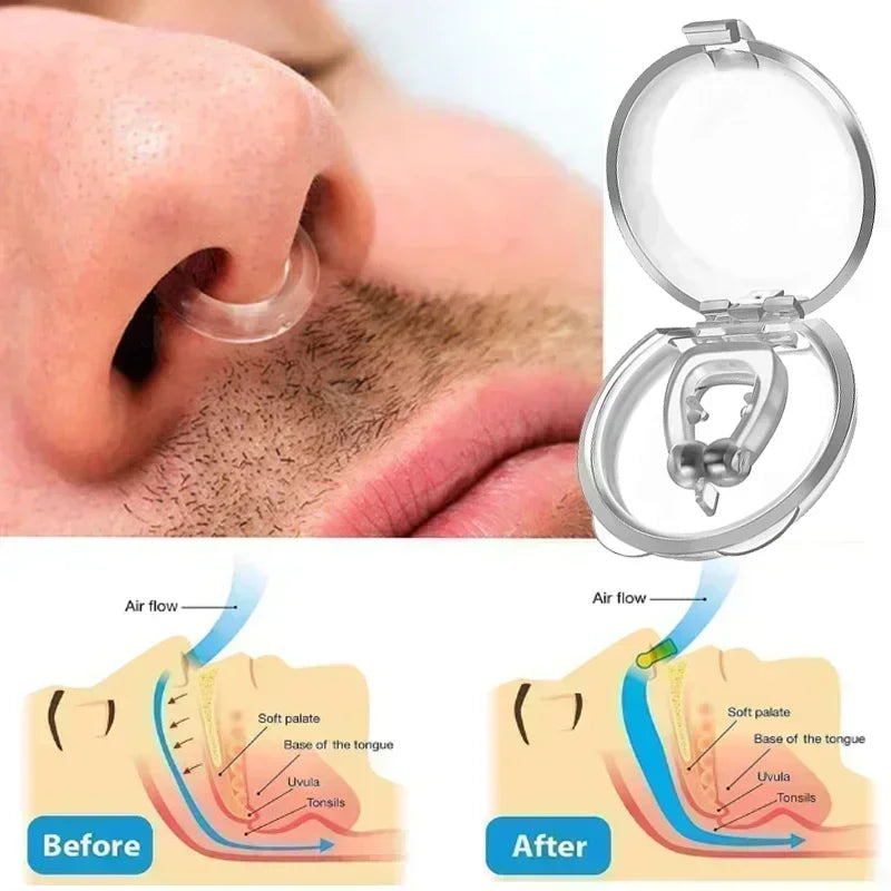 Anti-Snore Nose Clip™